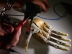 Mana bionica, inventata de un student roman